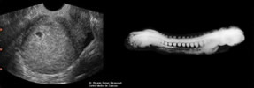 Embryonic Eco 4 weeks