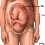 Gráfico referencial de una placenta normal