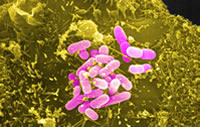 Escherichia coli