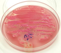 Colonias de E. coli