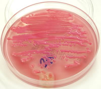 Colonies of E. coli