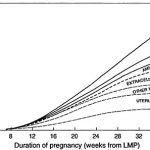 Gráfico de la distribución de la ganancia de peso durante el embarazo