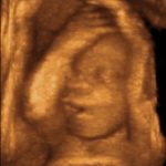 Expresión facial de un bebé en el útero